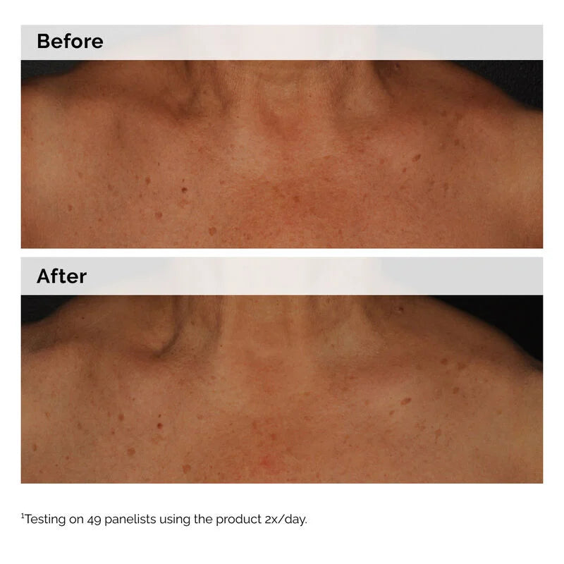 Niacinamide 5% Face and Body Emulsion